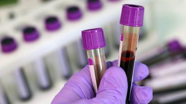 Maharashtra Shocker: 4 Thalassemic Children Test HIV Positive After Blood Transfusion in Nagpur